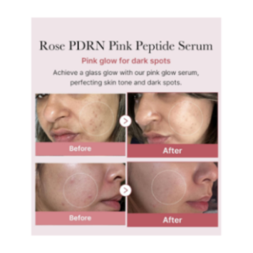 MEDICUBE SÉRUM AUX PEPTIDES ROSES PDRN