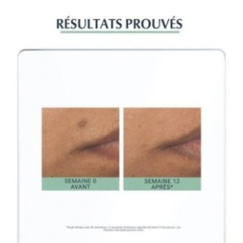 EUCERIN DERMOPURE SERUM TRIPLE ACTION 40ML