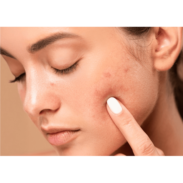 2- THE GLOW EXPERIENCES SOIN MAT & GLOW PEAUX MIXTES À GRASSES (PREMIUM)